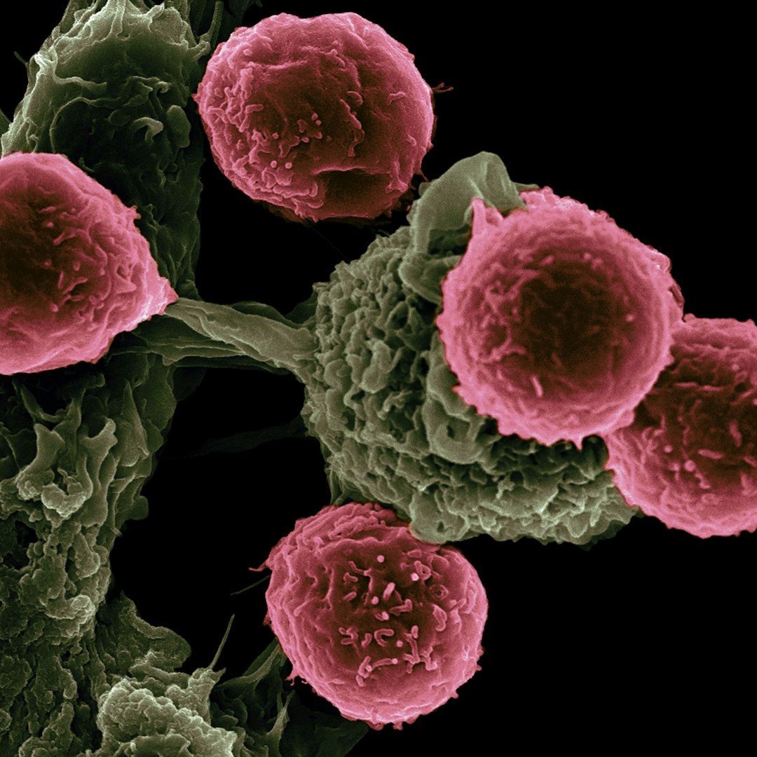 Nature Journal Issues Correction for Key CAR-NK Cancer Therapy Study