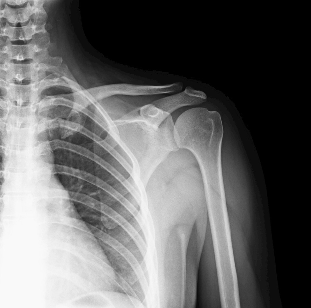 Meta Deploys AI Bone Structure Analysis to Identify Underage Users on Facebook and Instagram