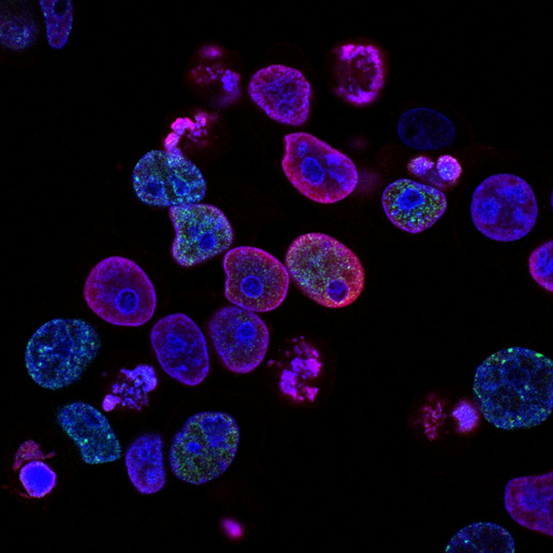 The Future of IVF: AI, Robotics, and Genetic Breakthroughs Reshape Assisted Reproduction